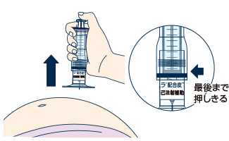 薬液を全量注入したことを確認した後に、皮膚をつまんでいた手をはなし、注射針を刺した角度と同じ角度で抜きます。