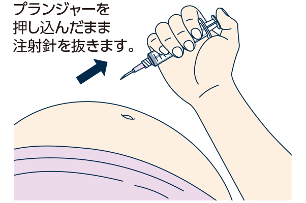 その他の注射筒の持ち方