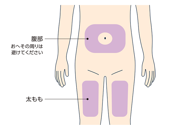 注射部位の決定