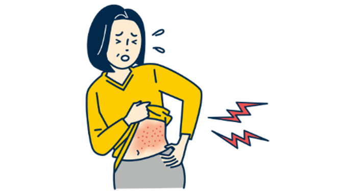 皮膚のチクチクする痛み、水ぶくれを伴う赤い発疹（帯状疱疹）