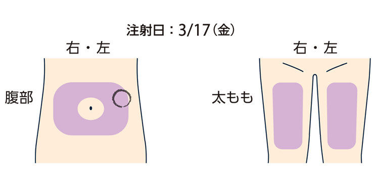 記入例