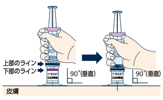 利き手で注射筒をもち、皮膚の「テント」の真ん中に注射針を45度～90度の角度※で優しく刺します。