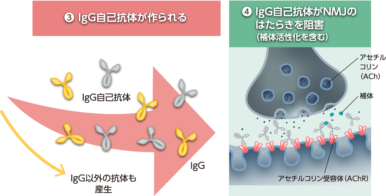 抗補体（C5）モノクローナル抗体製剤