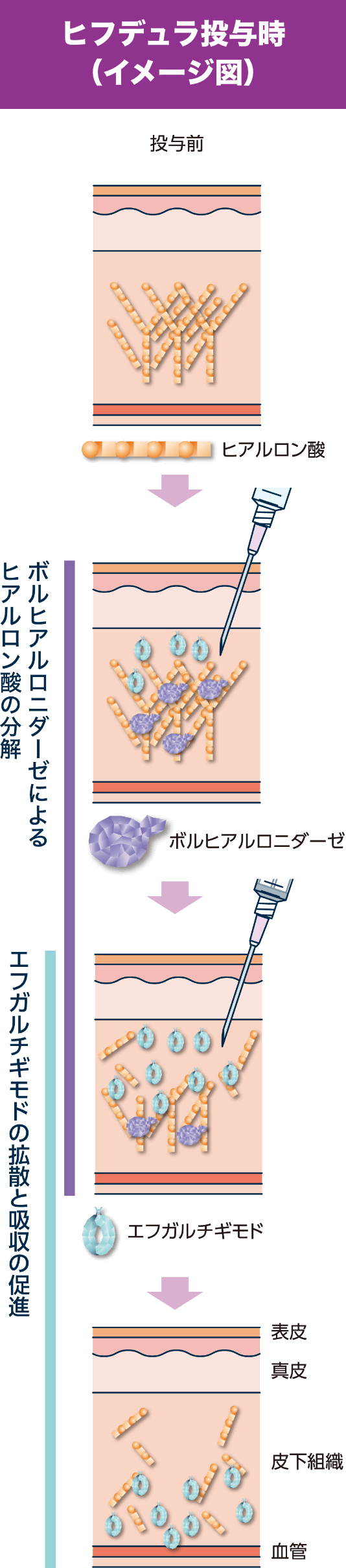 ヒフデュラ投与時（イメージ図）