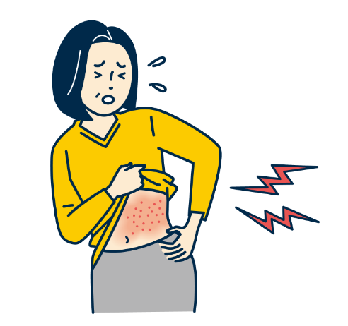 皮膚のチクチクする痛み、水ぶくれを伴う赤い発疹 （帯状疱疹)